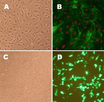 Human Pulmonary Artery Endothelial Cells (HPAEC)