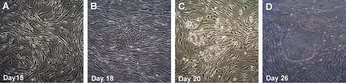 Time course of human iPSC colonies generation using Human Simplicon RNA Reprogramming Kit