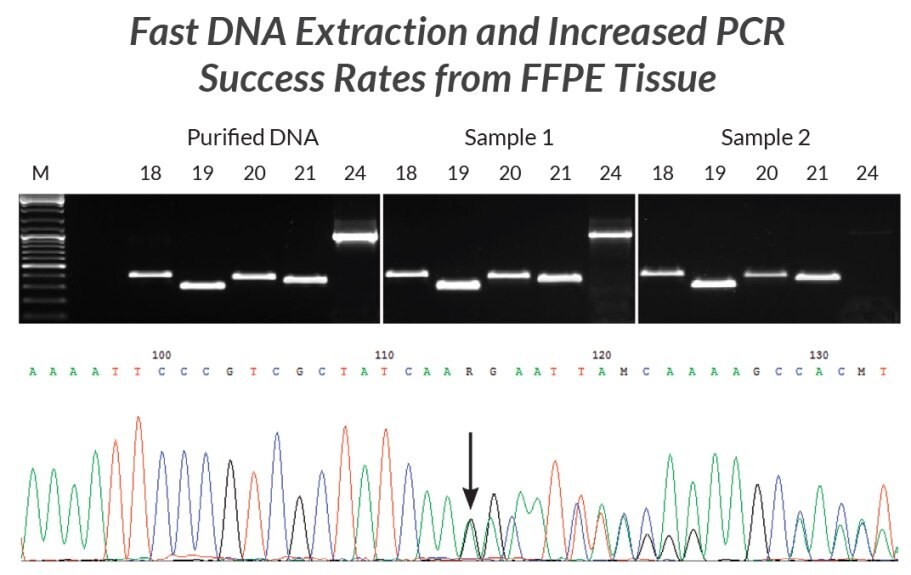 DNA 추출물은 KAPA Express Extract를 사용하여 두 개의 서로 다른 FFPE 샘플에서 제조되었습니다.