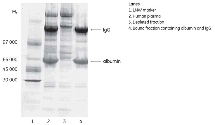 Deep Purple stained SDS-PAGE analysis (nonreducing conditions) of fractions from the depletion of human plasma using HiTrap Albumin & IgG Depletion