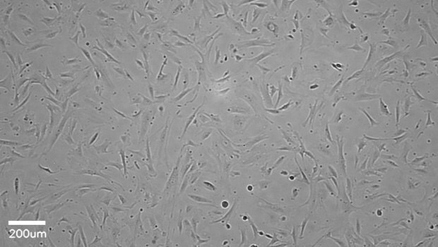 Stellate cells imaged after 4 days of incubation. Stellate cells were plated at a density of 4000 cells/cm2 on collagen-coated plate