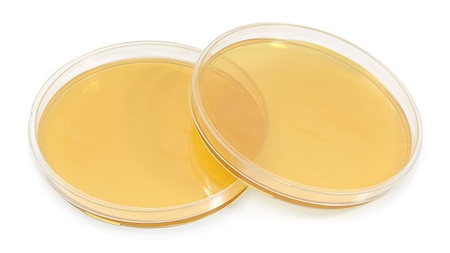 Two petri dishes filled with a yellowish agar medium are stacked slightly on top of each other. 