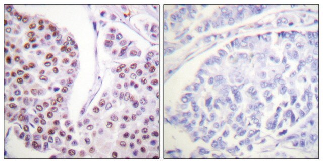 Anti-Histone H4 antibody produced in rabbit affinity isolated antibody