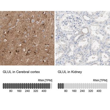 Anti-GLUL antibody produced in rabbit Ab2, Prestige Antibodies&#174; Powered by Atlas Antibodies, affinity isolated antibody, buffered aqueous glycerol solution