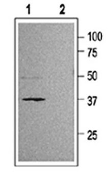 Anti-Potassium Channel Kir6.2 Antibody Chemicon&#174;, from rabbit