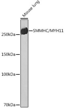 Anti-SMMHC/MYH11 Antibody, clone 0O4O4, Rabbit Monoclonal