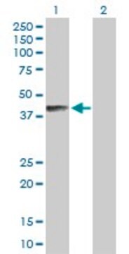 Anti-B4GALNT1 antibody produced in rabbit purified immunoglobulin, buffered aqueous solution