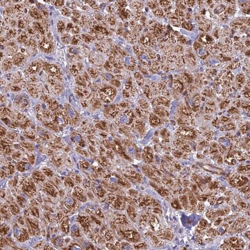 Anti-POMGNT1 antibody produced in rabbit Prestige Antibodies&#174; Powered by Atlas Antibodies, affinity isolated antibody, buffered aqueous glycerol solution