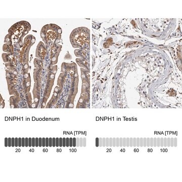 Anti-DNPH1 antibody produced in rabbit Prestige Antibodies&#174; Powered by Atlas Antibodies, affinity isolated antibody, buffered aqueous glycerol solution, ab1