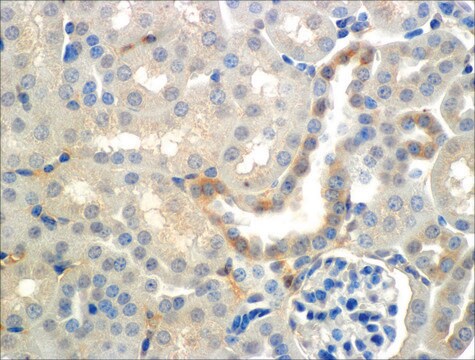 Monoclonal Anti-ENaC beta-Atto 488 antibody produced in mouse clone 7B8