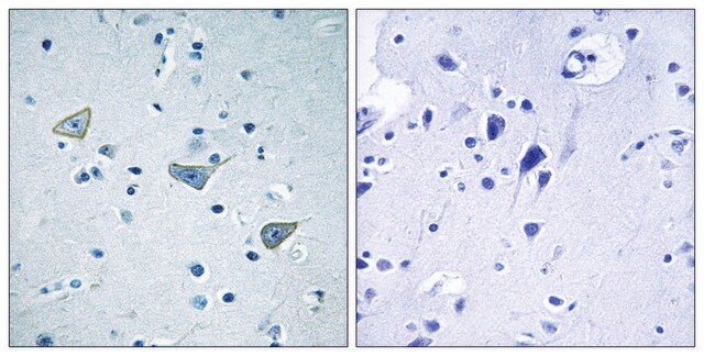 Anti-GPR158 antibody produced in rabbit affinity isolated antibody