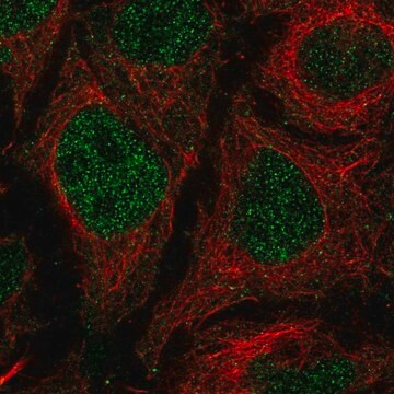 Anti-TMEM8A antibody produced in rabbit Prestige Antibodies&#174; Powered by Atlas Antibodies, affinity isolated antibody