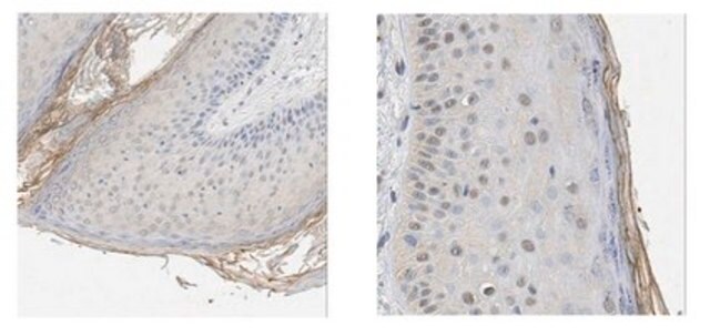 Anti-Kallikrein-5 Antibody/KLK5 from rabbit, purified by affinity chromatography