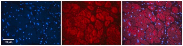 Anti-TMED1 antibody produced in rabbit affinity isolated antibody