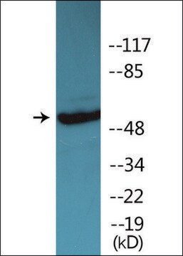 Anti-phospho-Vimentin (pSer83) antibody produced in rabbit affinity isolated antibody