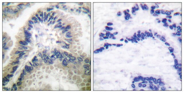 Anti-Guanylate Cyclase &#946; antibody produced in rabbit affinity isolated antibody