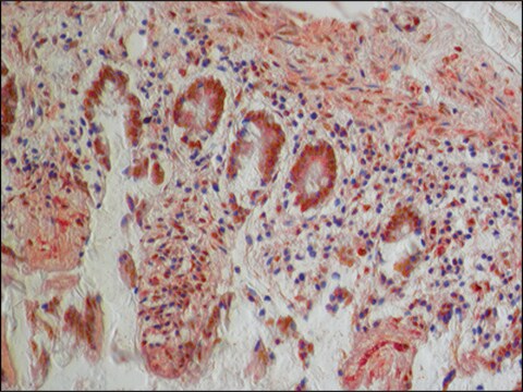 Anti-PKM2 (isoform M1) antibody produced in rabbit ~1.5&#160;mg/mL, affinity isolated antibody