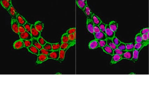 Anti-SRF [Serum Response Factor] Antibody, clone 1E1 clone 1E1, from mouse