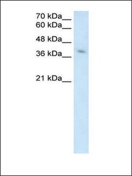 Anti-MICA antibody produced in rabbit IgG fraction of antiserum