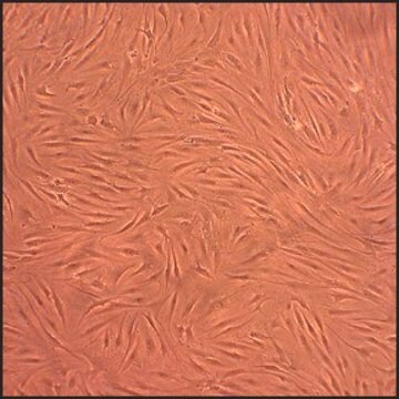 Human Fibroblast-Like Synoviocytes-Osteoarthritis: HFLS-OA, adult