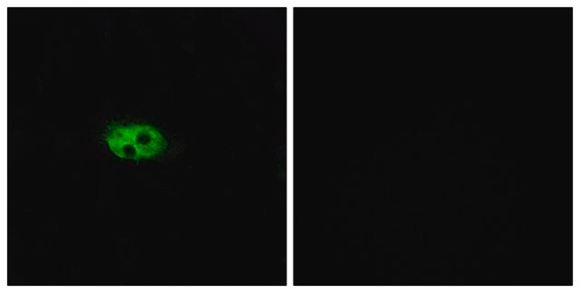 Anti-NK3R, C-Terminal antibody produced in rabbit affinity isolated antibody