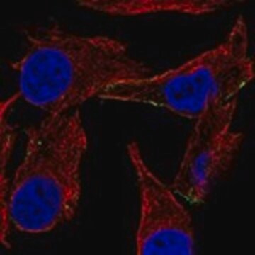 Anti-DCT antibody produced in rabbit Prestige Antibodies&#174; Powered by Atlas Antibodies, affinity isolated antibody, buffered aqueous glycerol solution