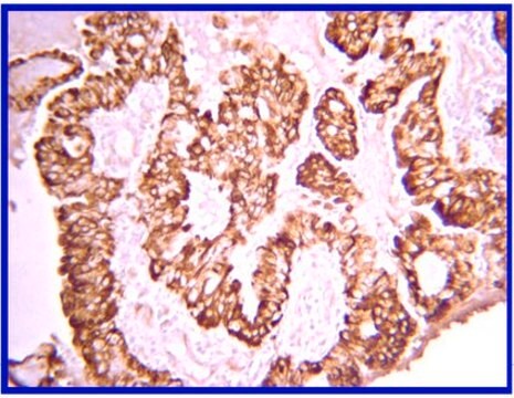 Anti-PDGF-AA Antibody from rabbit, purified by affinity chromatography