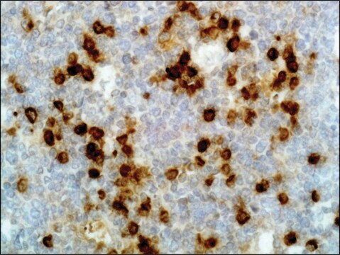 Anti-Human Lambda Light Chain antibody, Rabbit monoclonal recombinant, expressed in HEK 293 cells, clone RM127, purified immunoglobulin