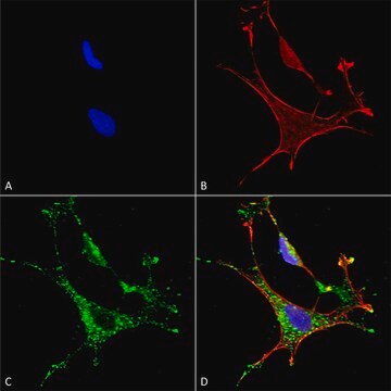 Monoclonal Anti-Copper Transporting Atpase 1 - Hrp antibody produced in mouse clone S60-4, purified immunoglobulin