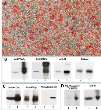 Human Preadipocytes: HPAd: Pre-Screened for Adipogenesis Signaling, adult subcutaneous