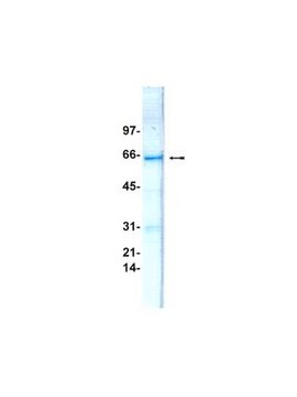 MKK4/SKK1 Protein, inactive, 50 g Unactive, recombinant mouse MKK4, corresponding to amino acids 35-397, fused to an N-terminal GST-tag, for use in Kinase Assays.