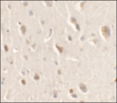 Anti-ULK1 antibody produced in rabbit affinity isolated antibody