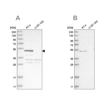 Anti-SCP2 antibody produced in rabbit Prestige Antibodies&#174; Powered by Atlas Antibodies, affinity isolated antibody, buffered aqueous glycerol solution, Ab2