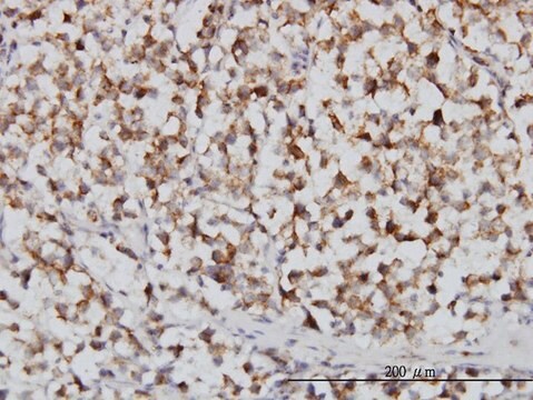 Monoclonal Anti-FH, (C-terminal) antibody produced in mouse clone 3E7, purified immunoglobulin, buffered aqueous solution