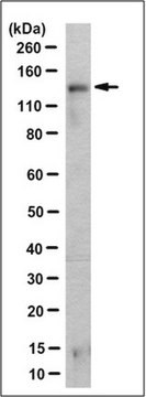 Anti-Tankyrase-2 Antibody, clone 2F5.1 clone 2F5.1, from mouse