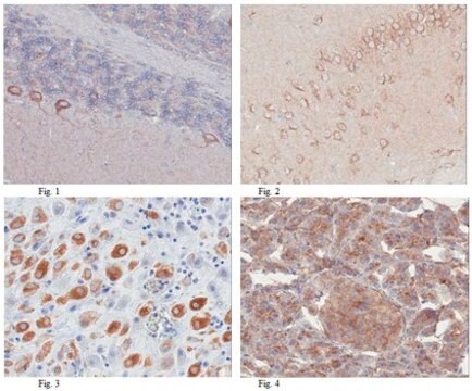 Anti-TFG Antibody from rabbit