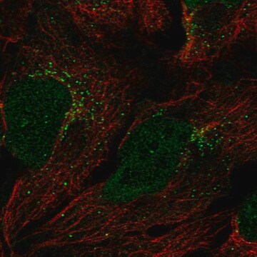 Anti-GGT7 antibody produced in rabbit Prestige Antibodies&#174; Powered by Atlas Antibodies, affinity isolated antibody