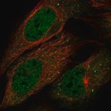 Anti-B4GALNT4 antibody produced in rabbit Prestige Antibodies&#174; Powered by Atlas Antibodies, affinity isolated antibody, buffered aqueous glycerol solution