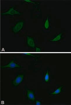 Anti-Munc-18-1 antibody produced in rabbit IgG fraction of antiserum, buffered aqueous solution