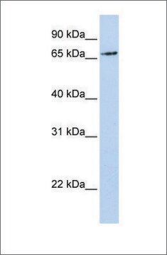 Anti-RNF139 antibody produced in rabbit affinity isolated antibody