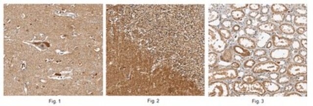 Anti-TRAPPC1 Antibody from rabbit, purified by affinity chromatography