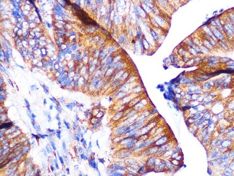 Anti-PAR2 Antibody, clone 9X8E6, Rabbit Monoclonal