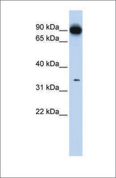 Anti-PRKRA antibody produced in rabbit affinity isolated antibody