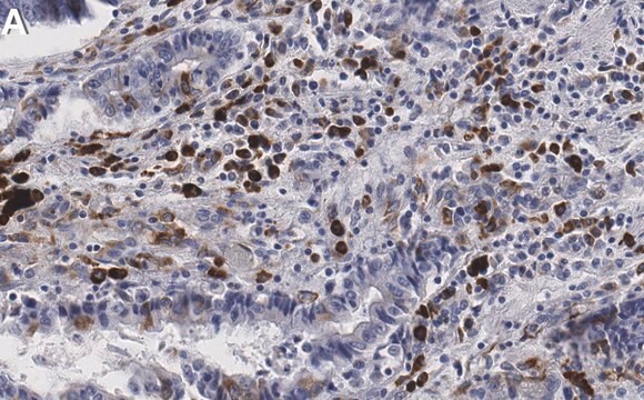 Anti-p-RPS6 (Ser240/244) Antibody, clone 2H10 ZooMAb&#174; Rabbit Monoclonal recombinant, expressed in HEK 293 cells