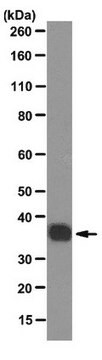 Anti-SMN2 Antibody, clone SMN-KH clone SMN-KH, from mouse