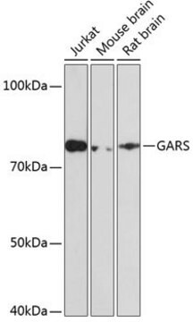 Anti-GARS antibody produced in rabbit