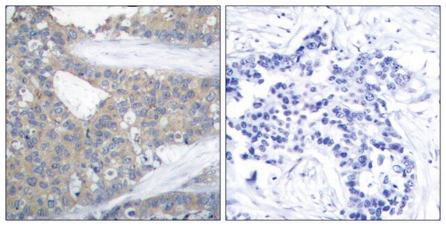 Anti-Paxillin antibody produced in rabbit affinity isolated antibody