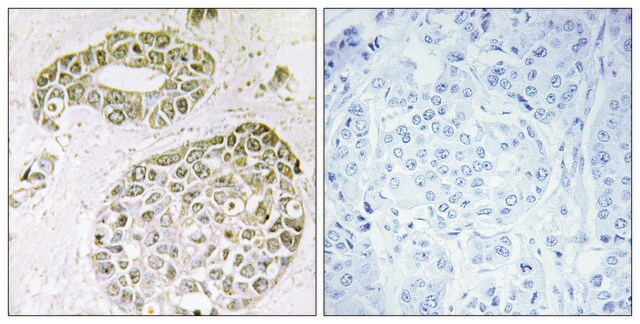 Anti-HNRNP M antibody produced in rabbit affinity isolated antibody