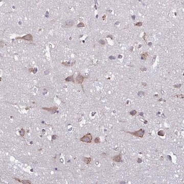 Anti-TMEM8C antibody produced in rabbit Prestige Antibodies&#174; Powered by Atlas Antibodies, affinity isolated antibody, buffered aqueous glycerol solution