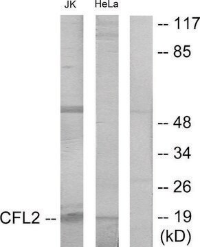 Anti-Cofilin antibody produced in rabbit affinity isolated antibody